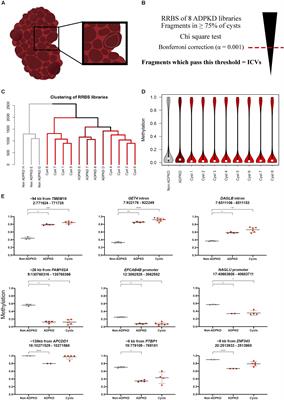 Extensive Inter-Cyst DNA Methylation Variation in Autosomal Dominant Polycystic Kidney Disease Revealed by Genome Scale Sequencing